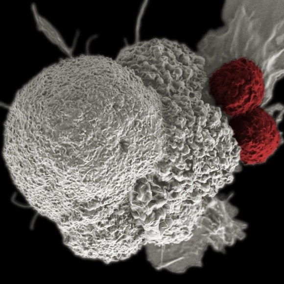 Pembrolizumab approved as standard firstline therapy for